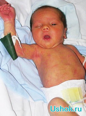 Анатомо-физиологические изюминки новорожденного ребенка