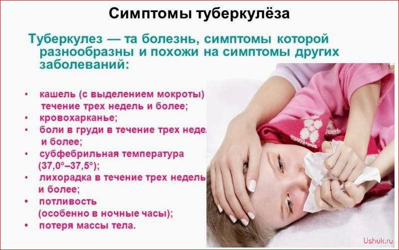 Туберкулез у детей: первые признаки и симптомы