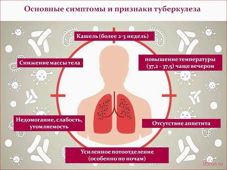 Туберкулез у детей: первые признаки и симптомы